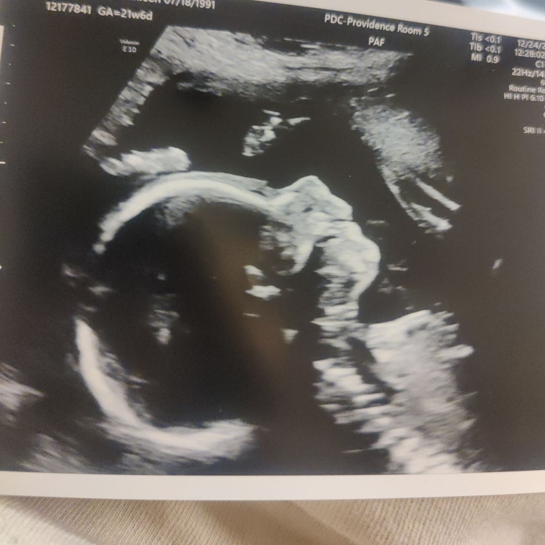 Photo shared by Olivia for their Babylist baby registry.