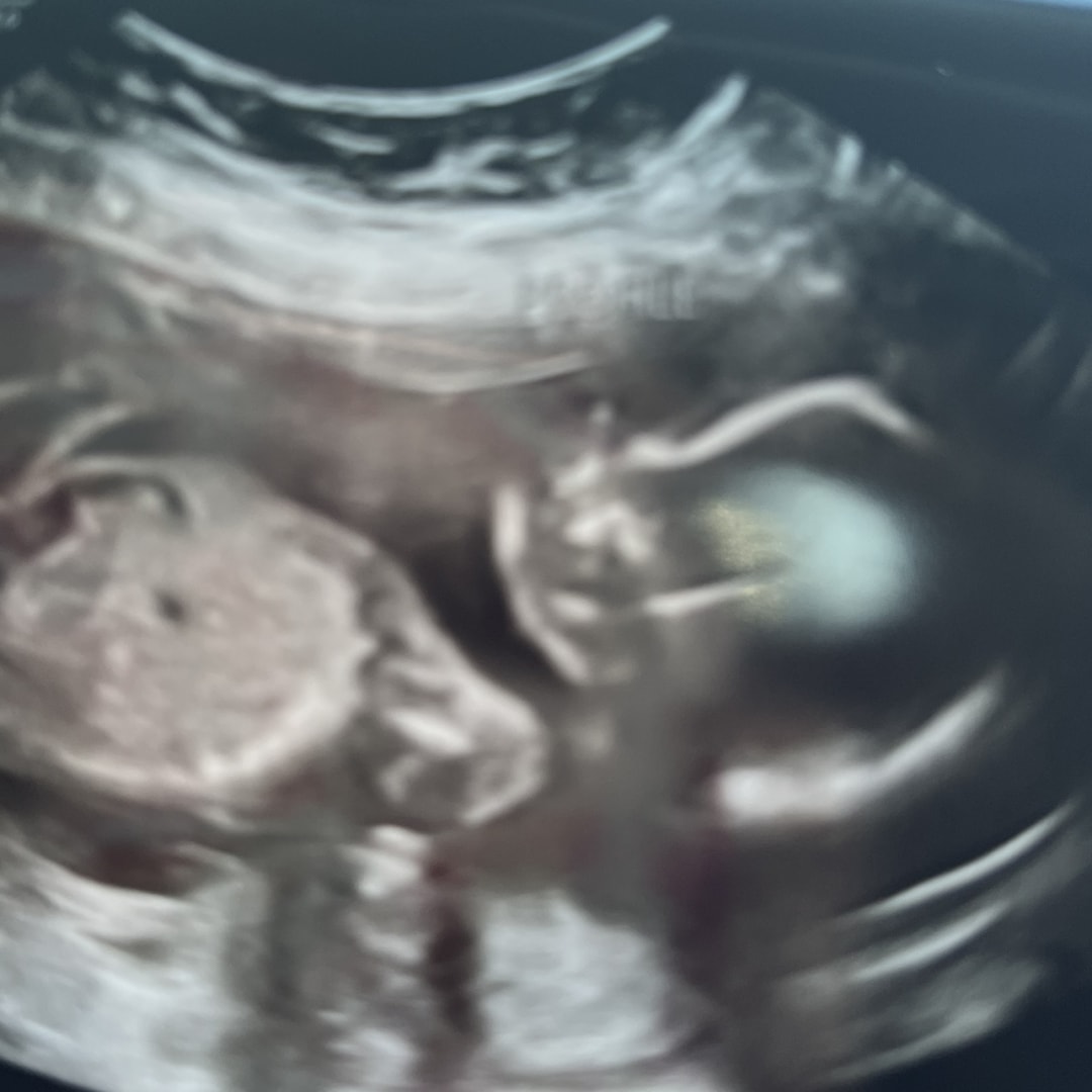 Photo shared by Katie for their Babylist baby registry.