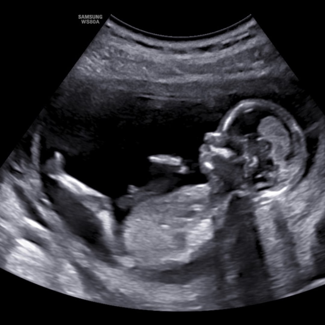 Photo shared by Mary for their Babylist baby registry.