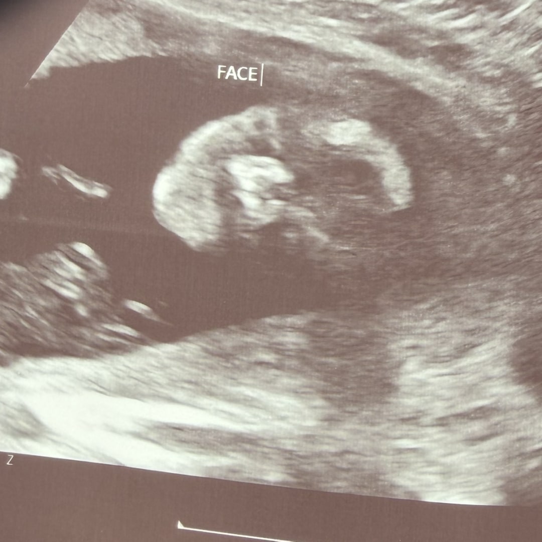 Photo shared by Maddie for their Babylist baby registry.