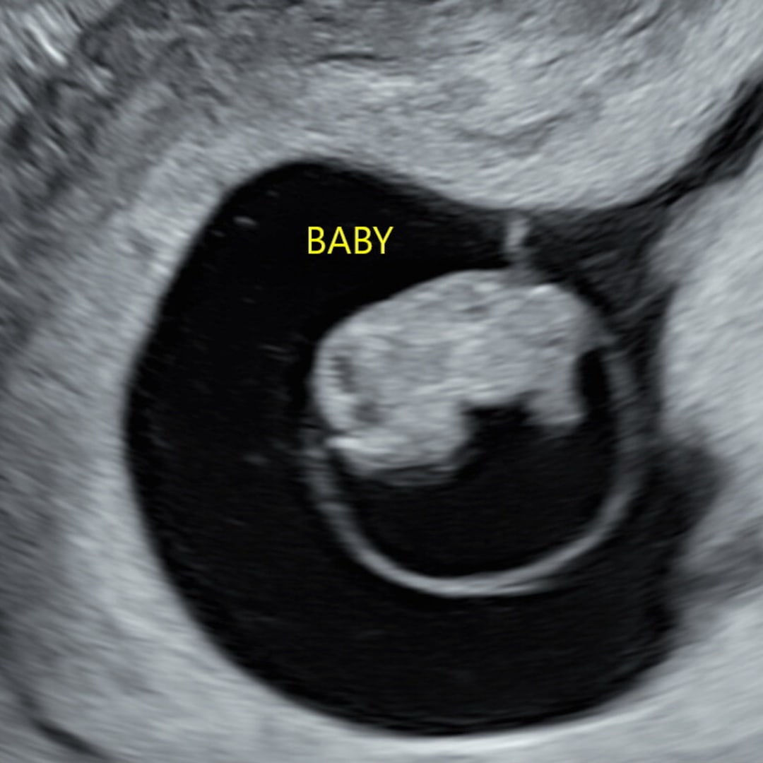 Photo shared by Maddie for their Babylist baby registry.