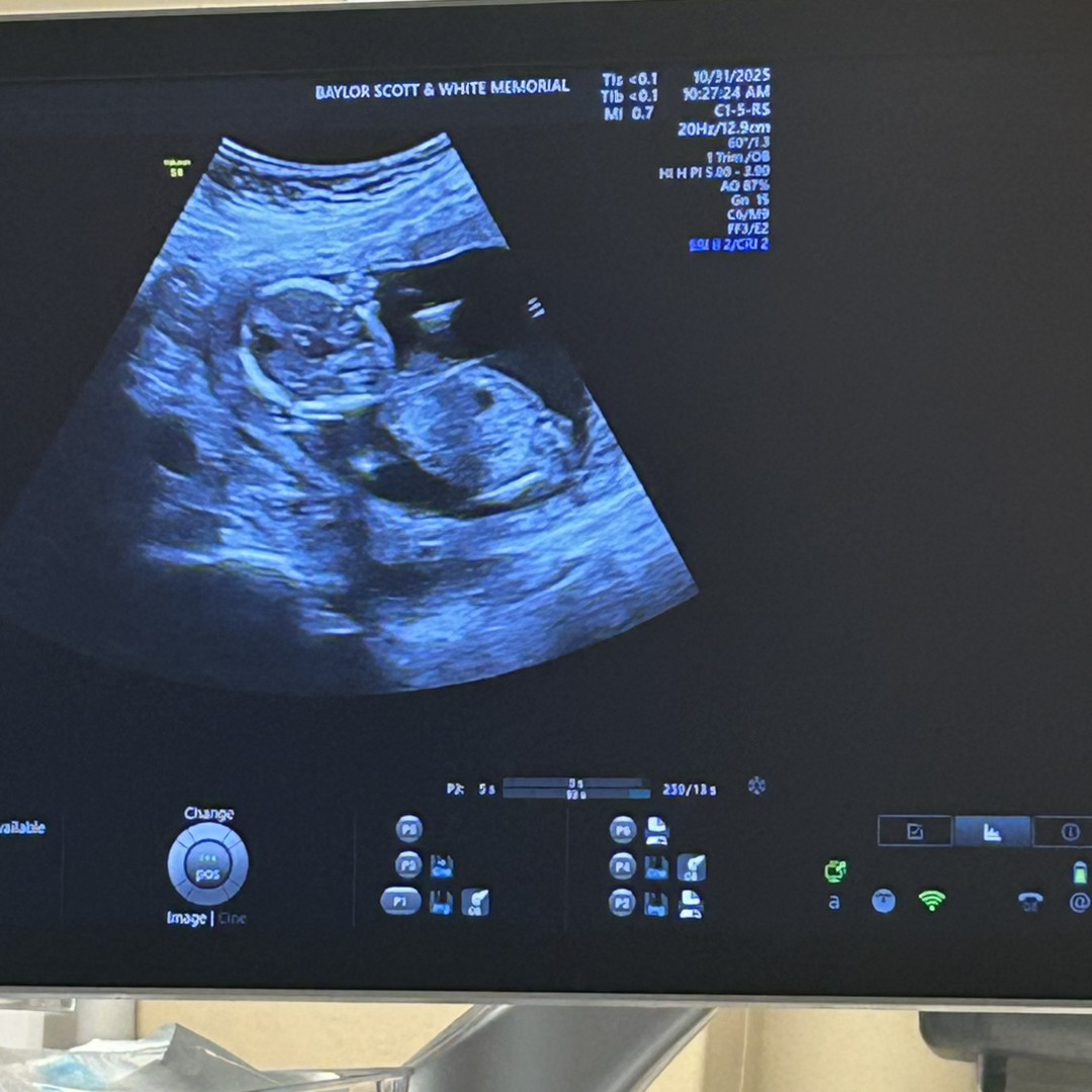 Photo shared by Taylor for their Babylist baby registry.