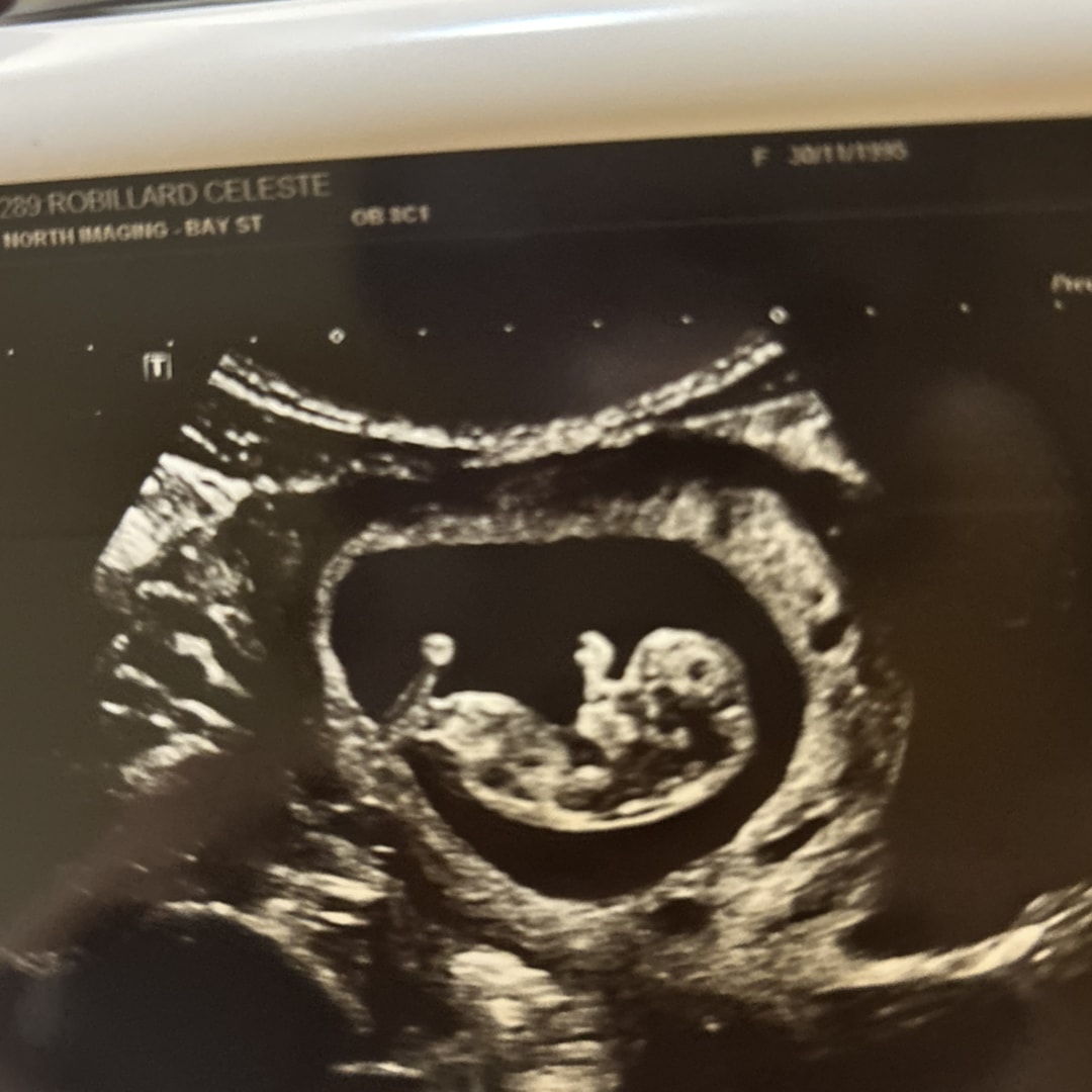 Photo shared by Celeste for their Babylist baby registry.