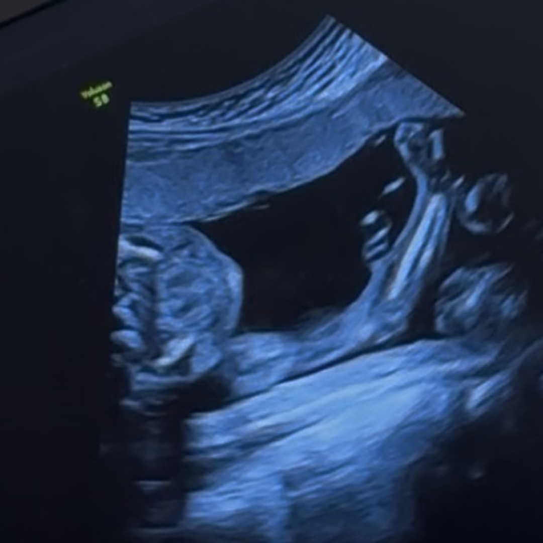 Photo shared by Shandera for their Babylist baby registry.