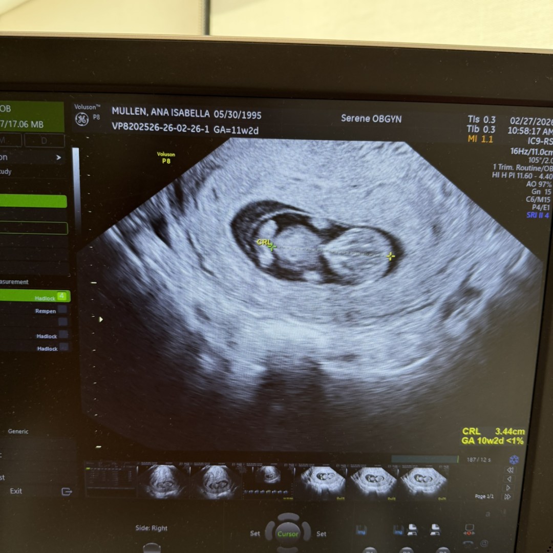 Photo shared by Isabella for their Babylist baby registry.