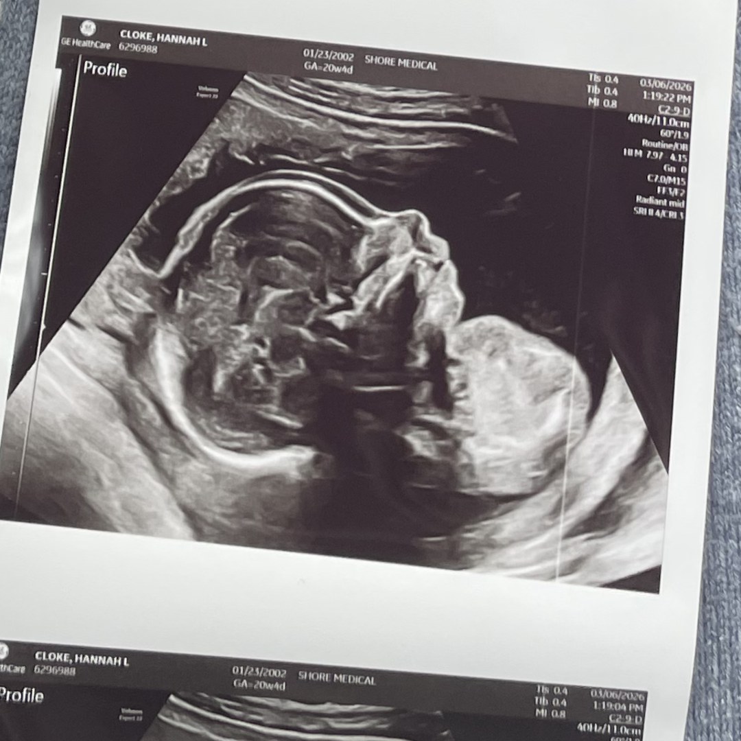 Photo shared by Hannah for their Babylist baby registry.