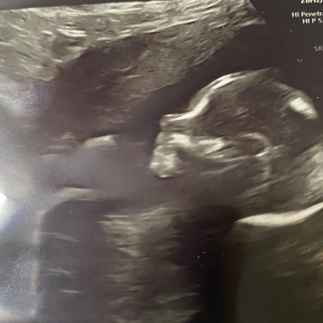 Photo shared by Jennalyn for their Babylist baby registry.