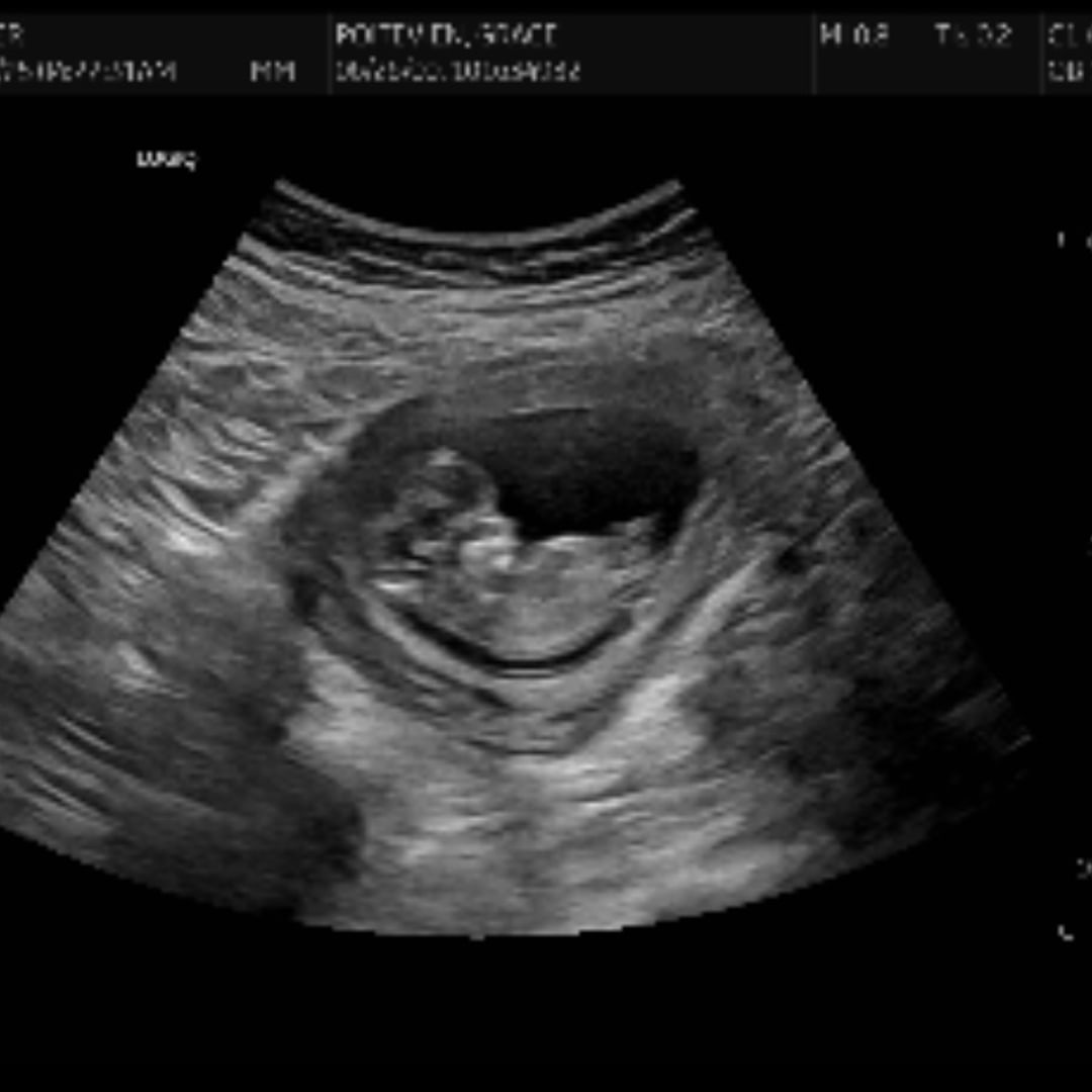 Photo shared by Grace for their Babylist baby registry.