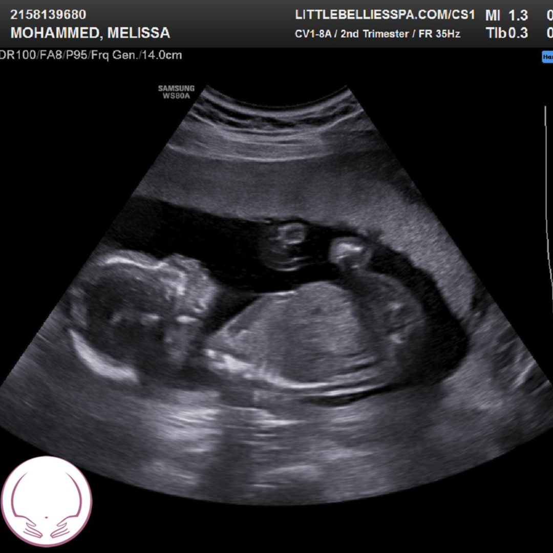 Photo shared by Melissa for their Babylist baby registry.