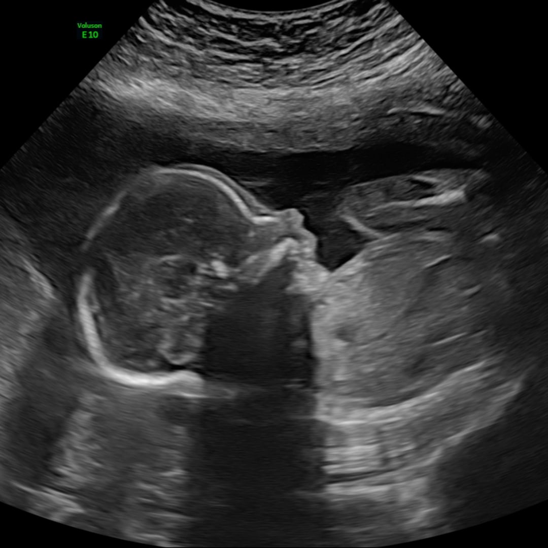 Photo shared by Rebecca for their Babylist baby registry.