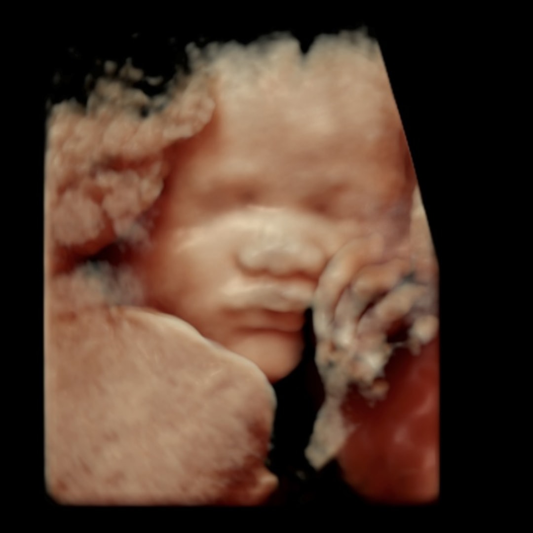 Photo shared by Jeizhelle for their Babylist baby registry.