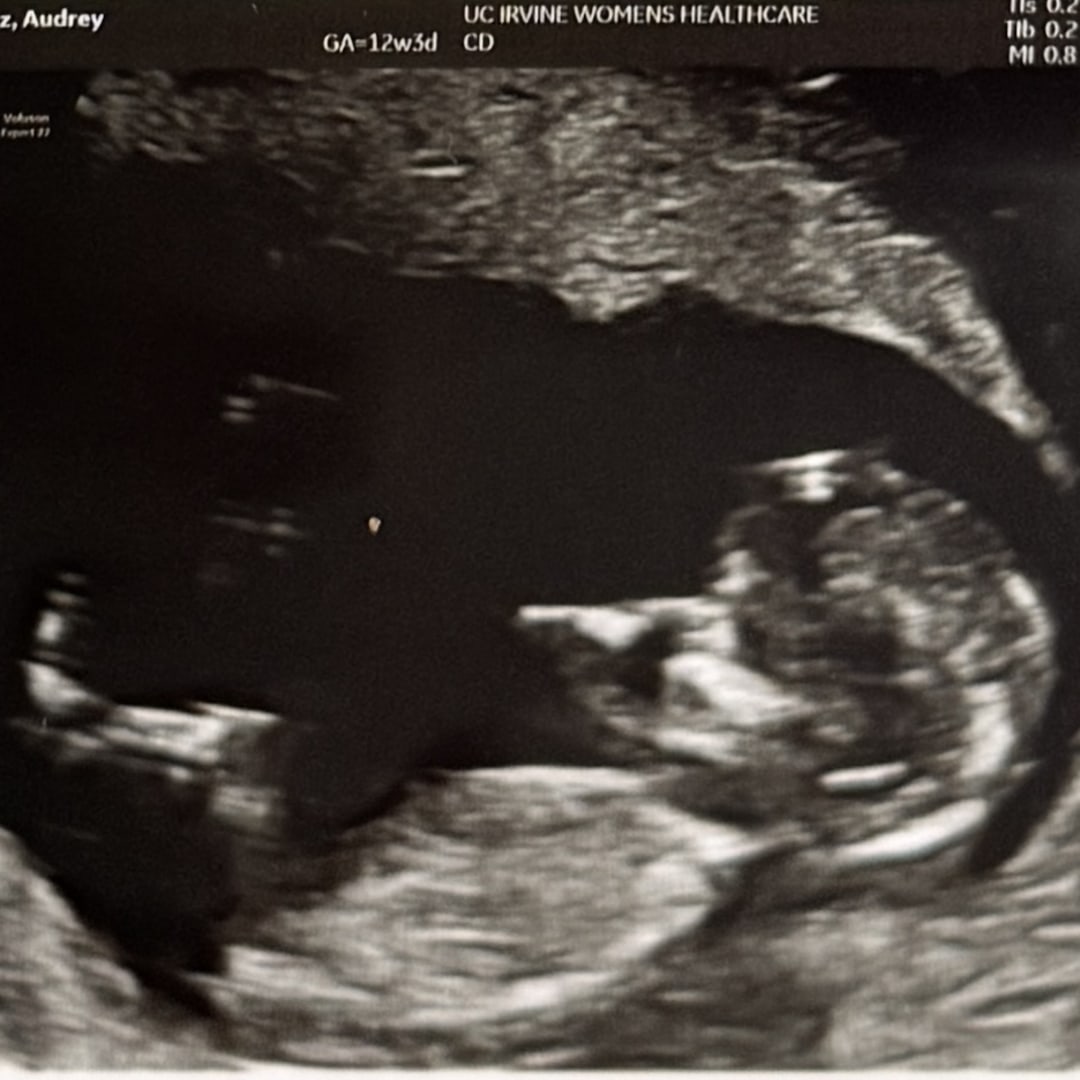 Photo shared by Audrey for their Babylist baby registry.
