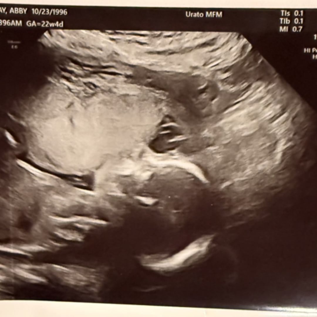 Photo shared by Abby for their Babylist baby registry.