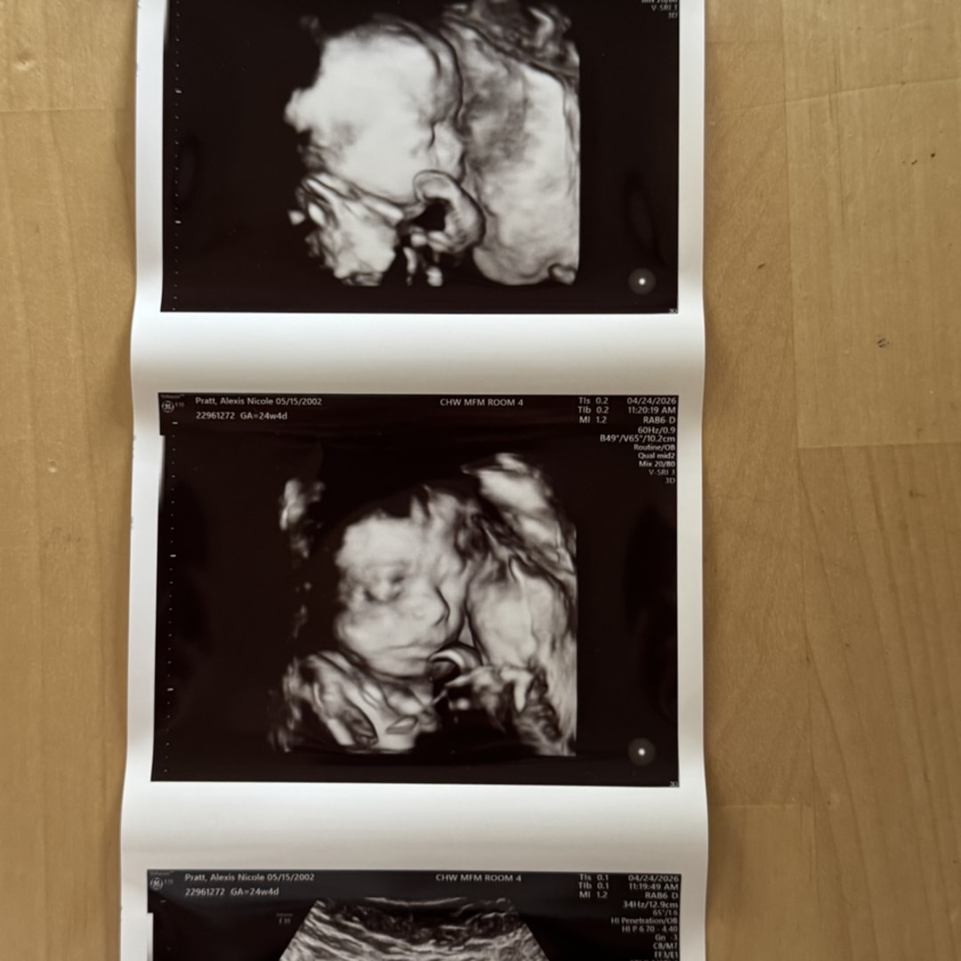 Photo shared by Alexis for their Babylist baby registry.