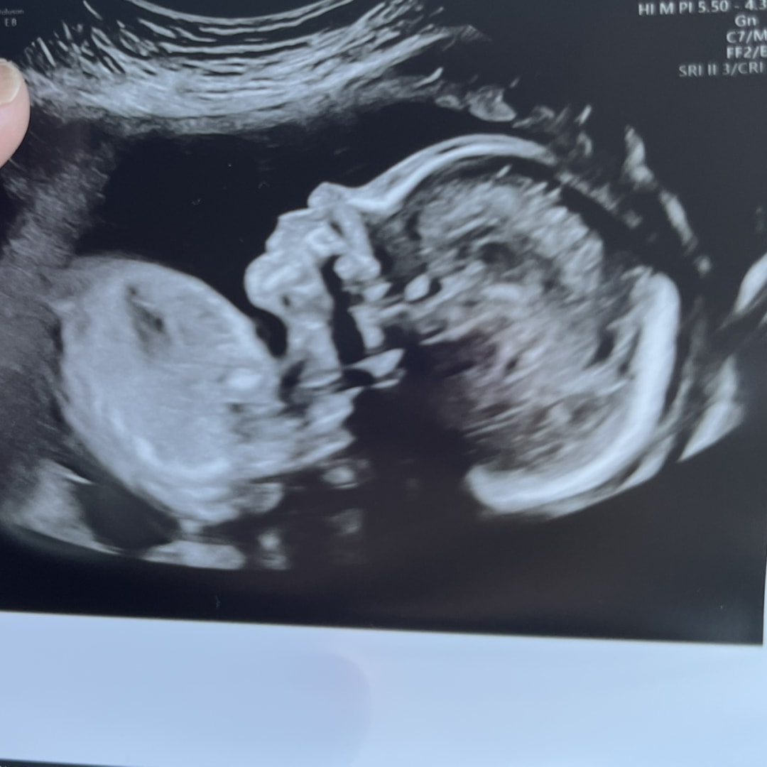 Photo shared by Jennifer for their Babylist baby registry.