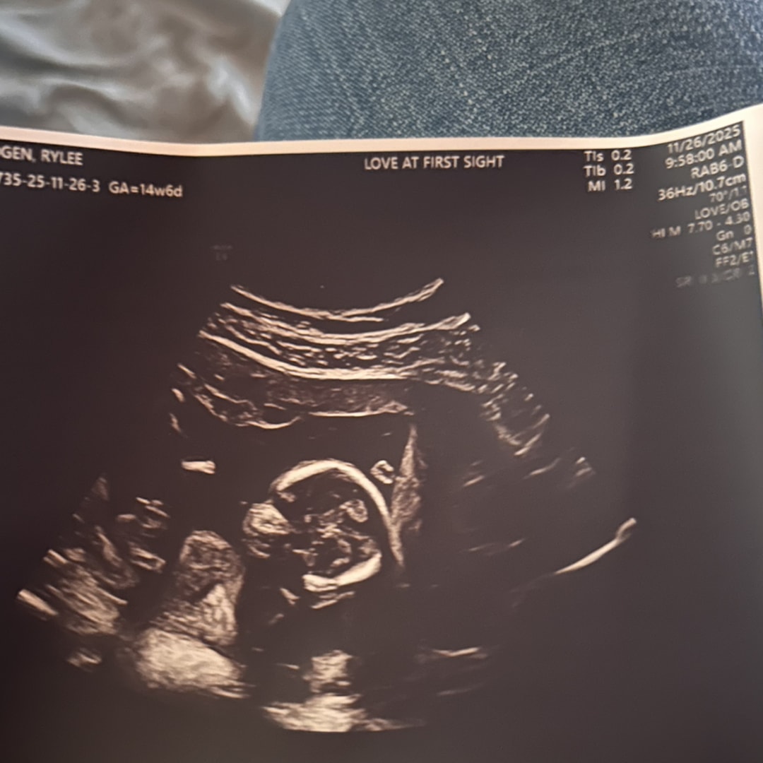 Photo shared by Rylee for their Babylist baby registry.