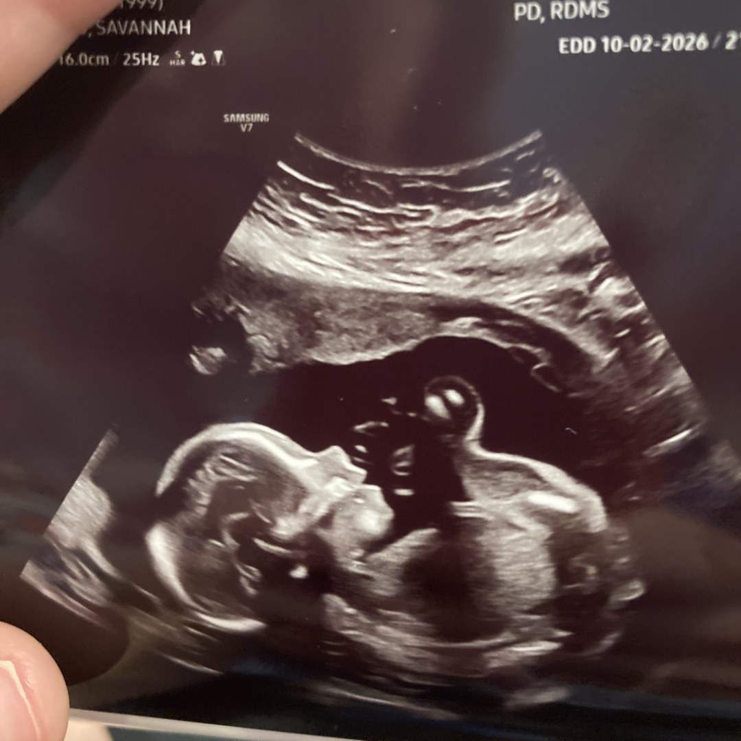 Photo shared by Savannah for their Babylist baby registry.