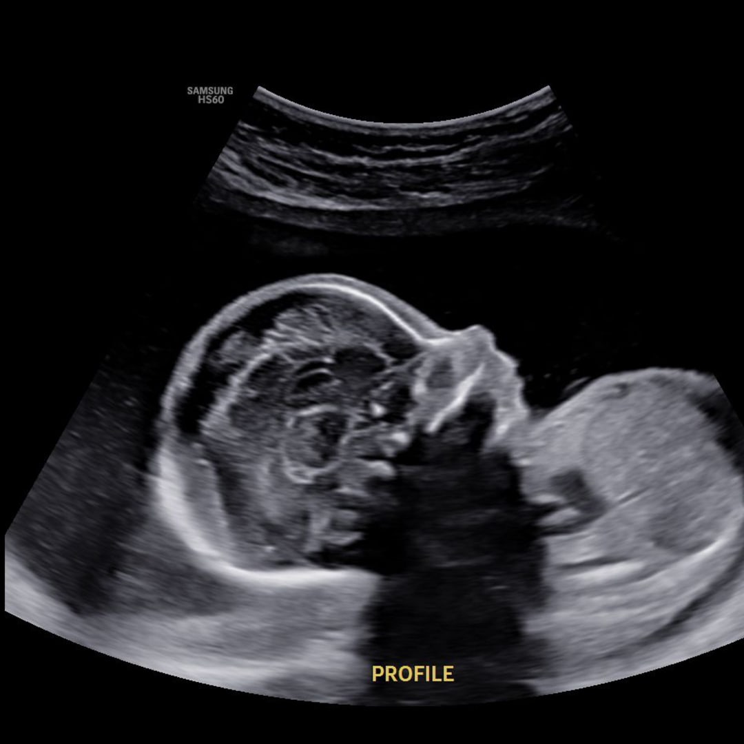 Photo shared by Brianna for their Babylist baby registry.