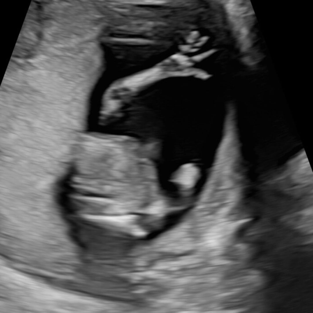 Photo shared by Caroline for their Babylist baby registry.