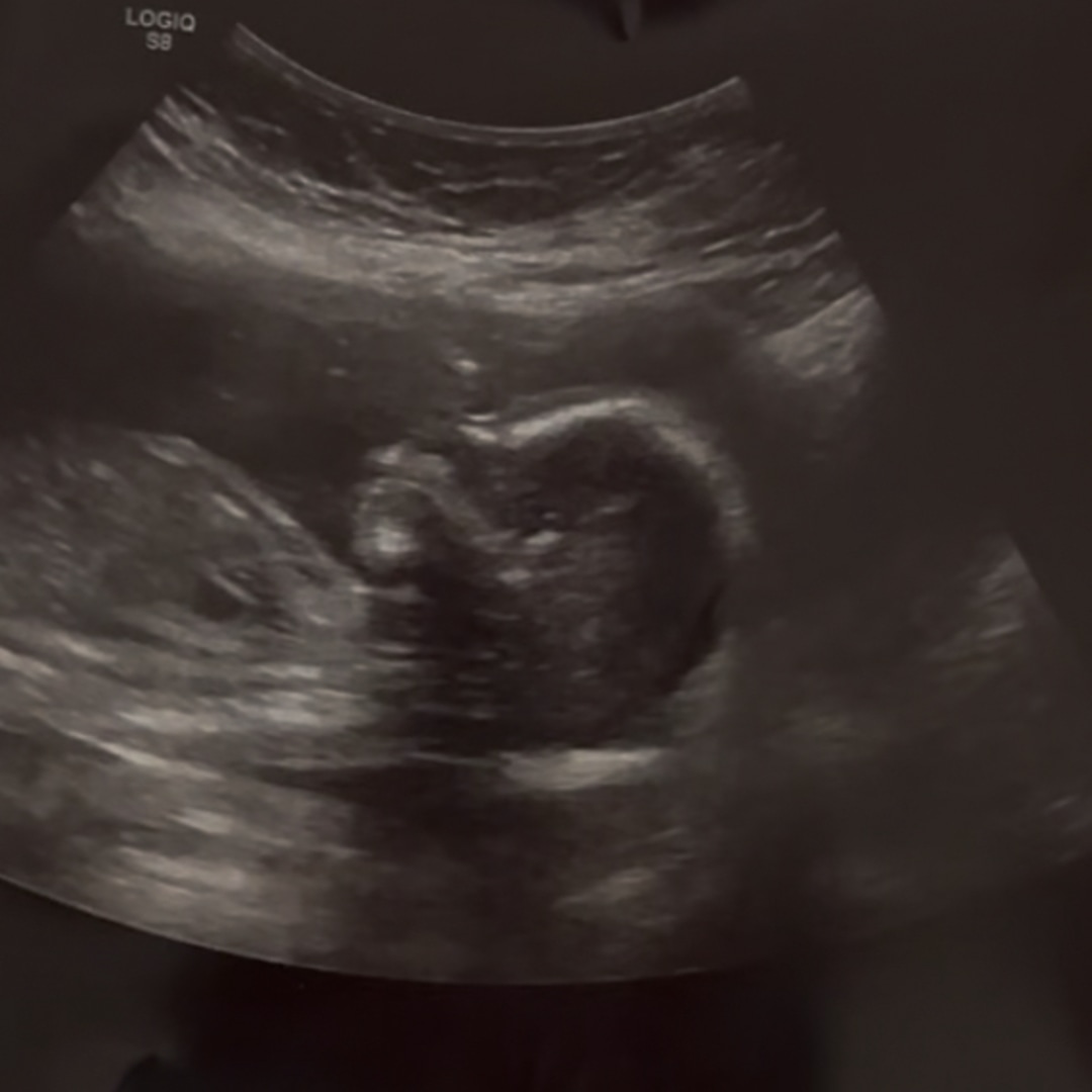 Photo shared by Kiersten for their Babylist baby registry.