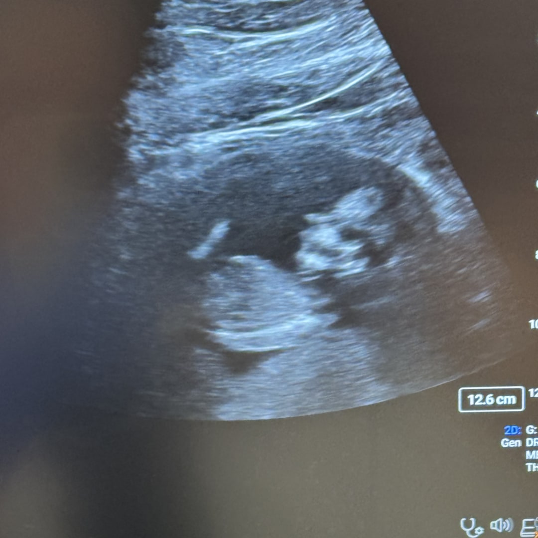 Photo shared by Jessica for their Babylist baby registry.