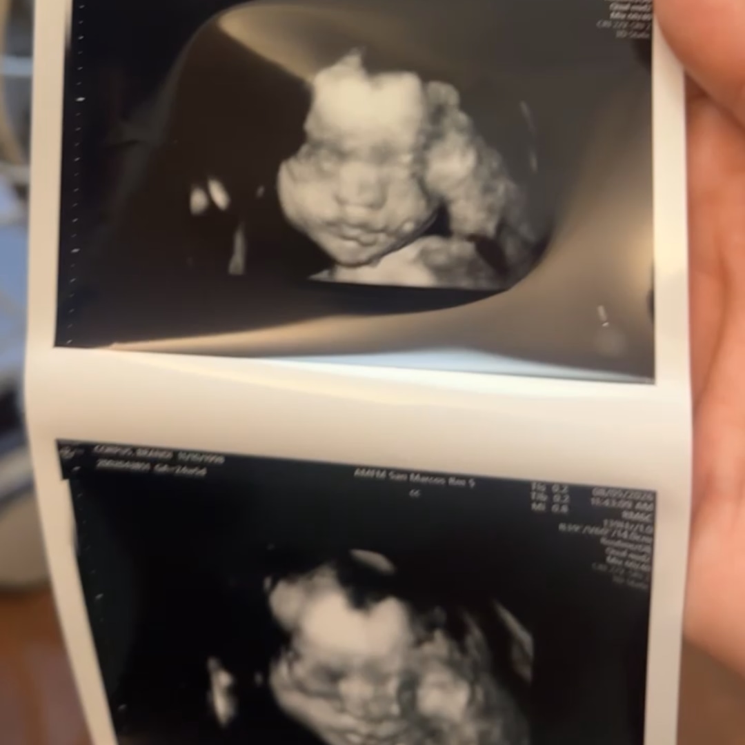 Photo shared by Brandi for their Babylist baby registry.