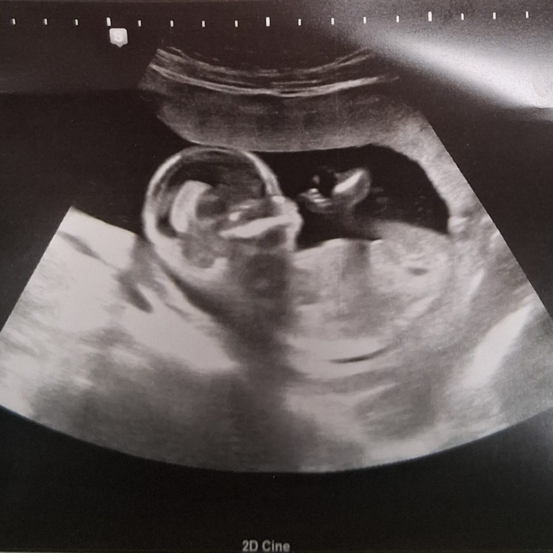 Photo shared by Candice for their Babylist baby registry.