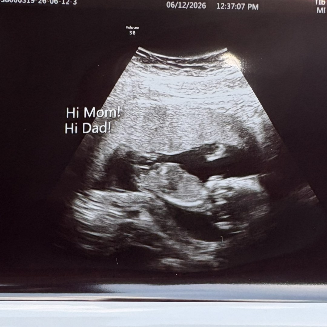 Photo shared by Renard for their Babylist baby registry.