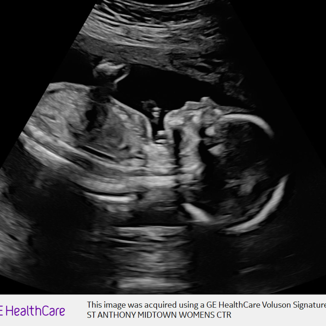 Photo shared by Jayden for their Babylist baby registry.