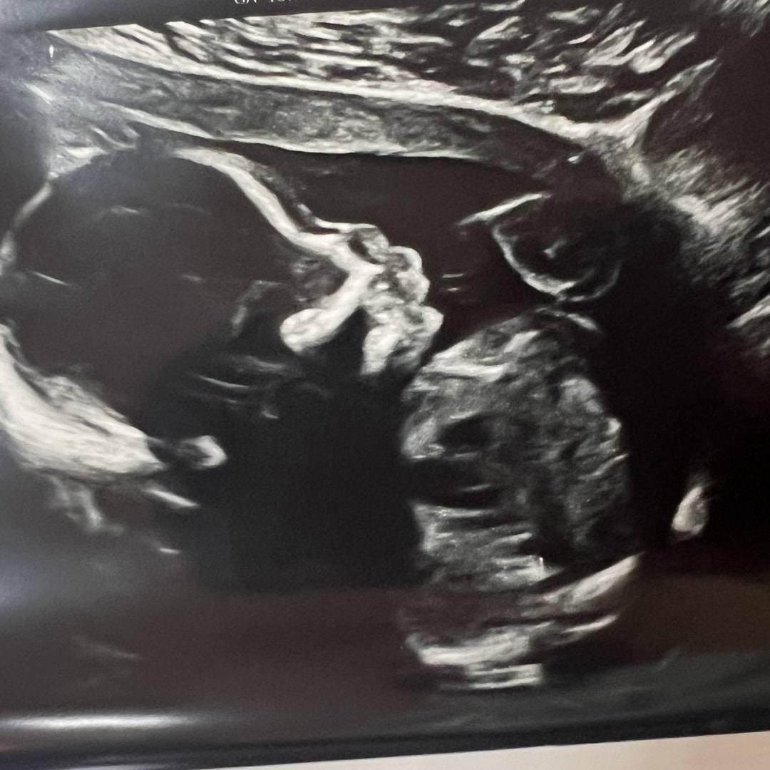 Photo shared by Krista for their Babylist baby registry.