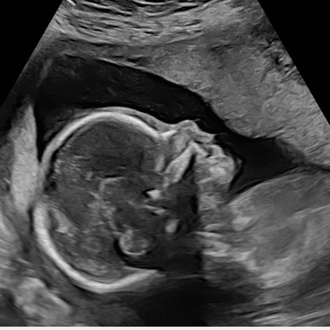 Photo shared by Allison for their Babylist baby registry.