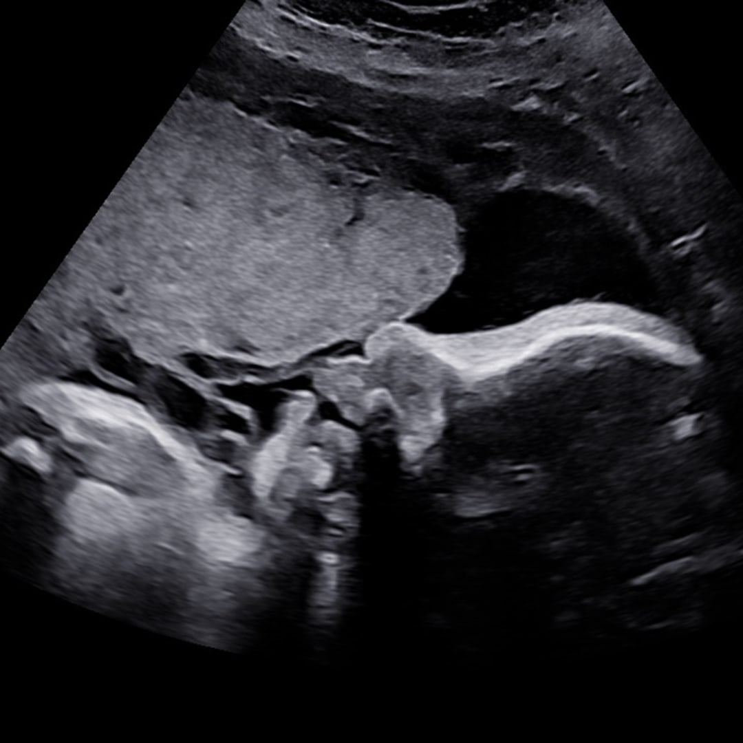 Photo shared by Zoe for their Babylist baby registry.