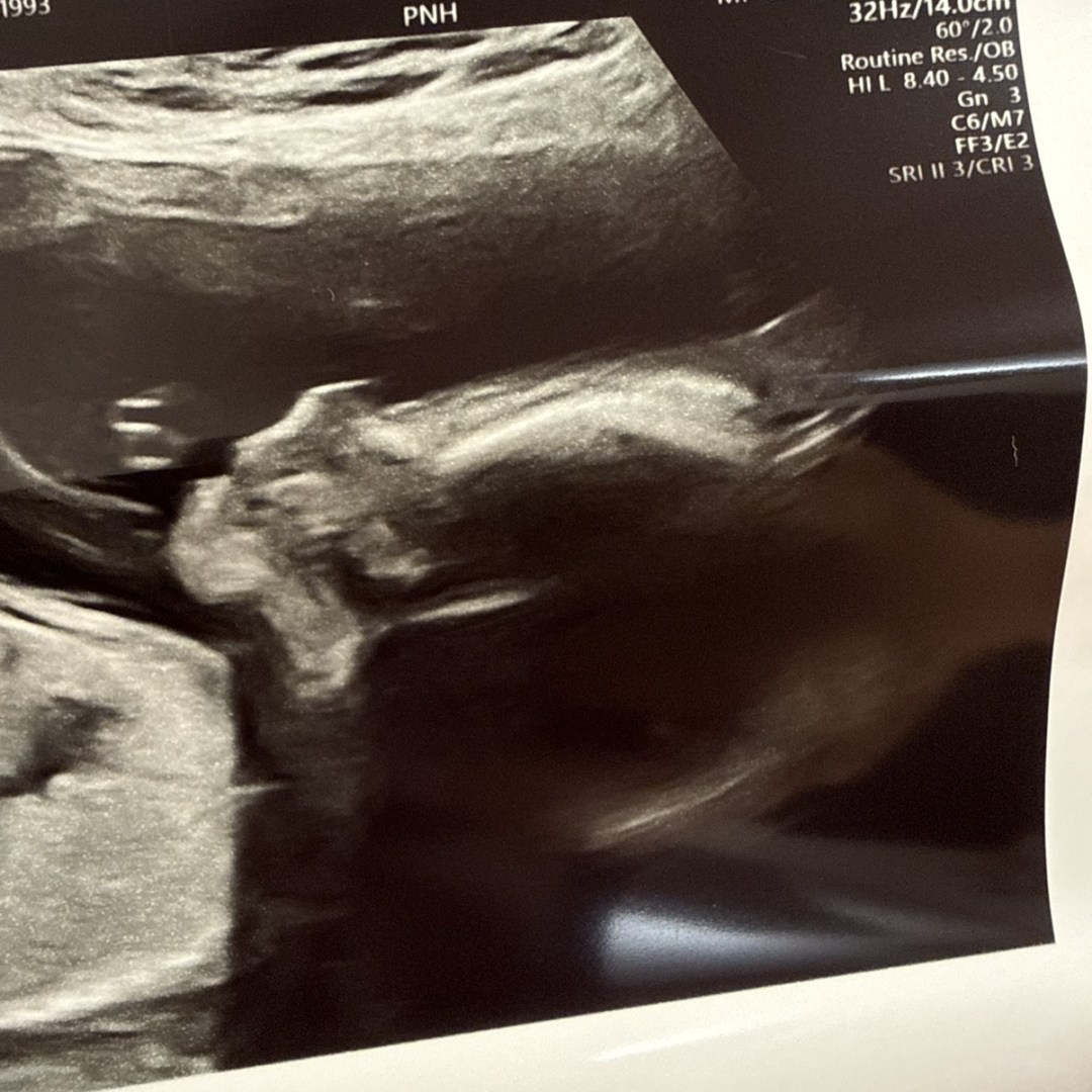 Photo shared by Dashae for their Babylist baby registry.