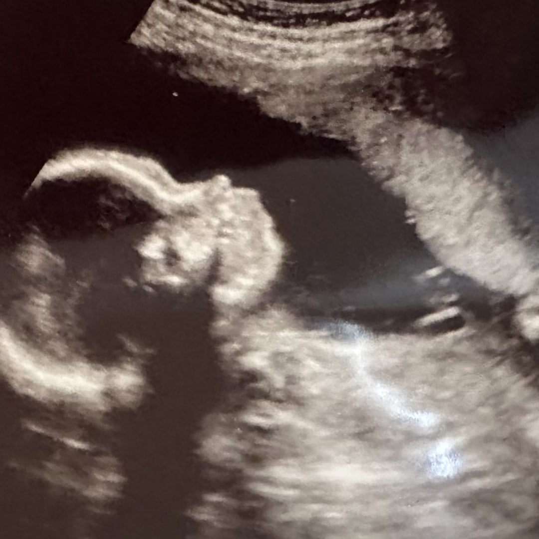 Photo shared by Desiree for their Babylist baby registry.