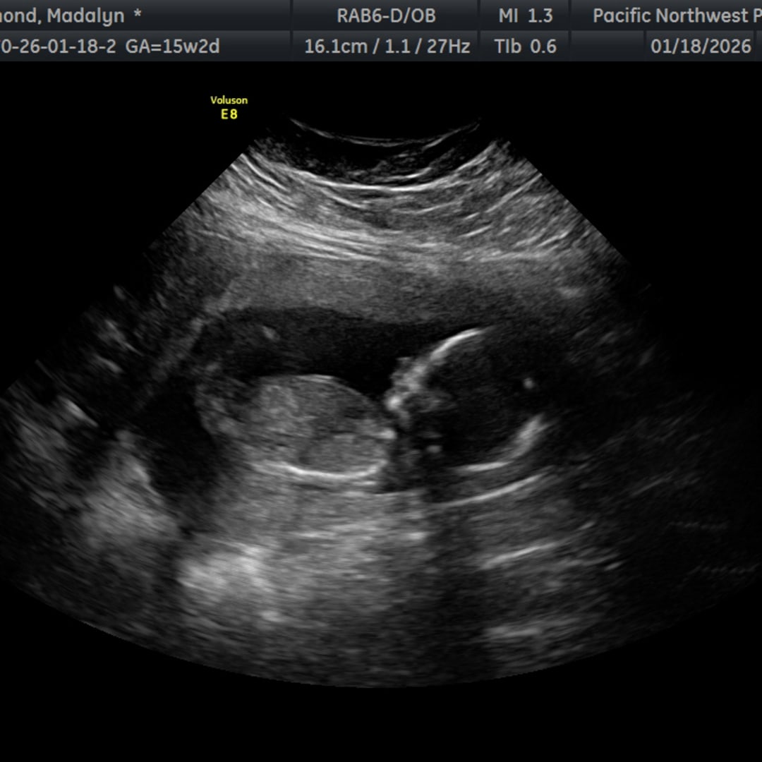 Photo shared by Madalyn for their Babylist baby registry.