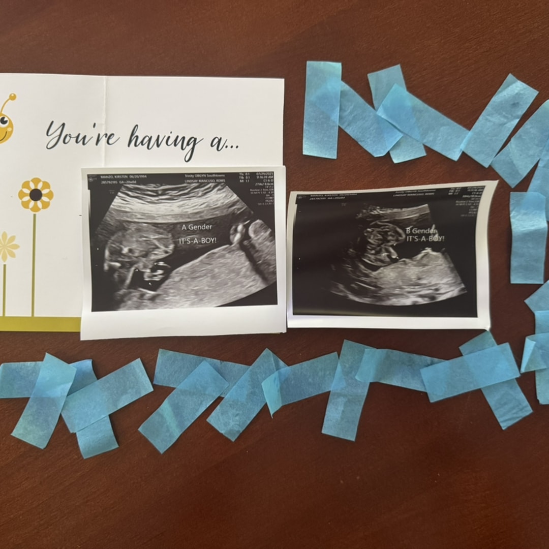 Photo shared by Kirsten for their Babylist baby registry.