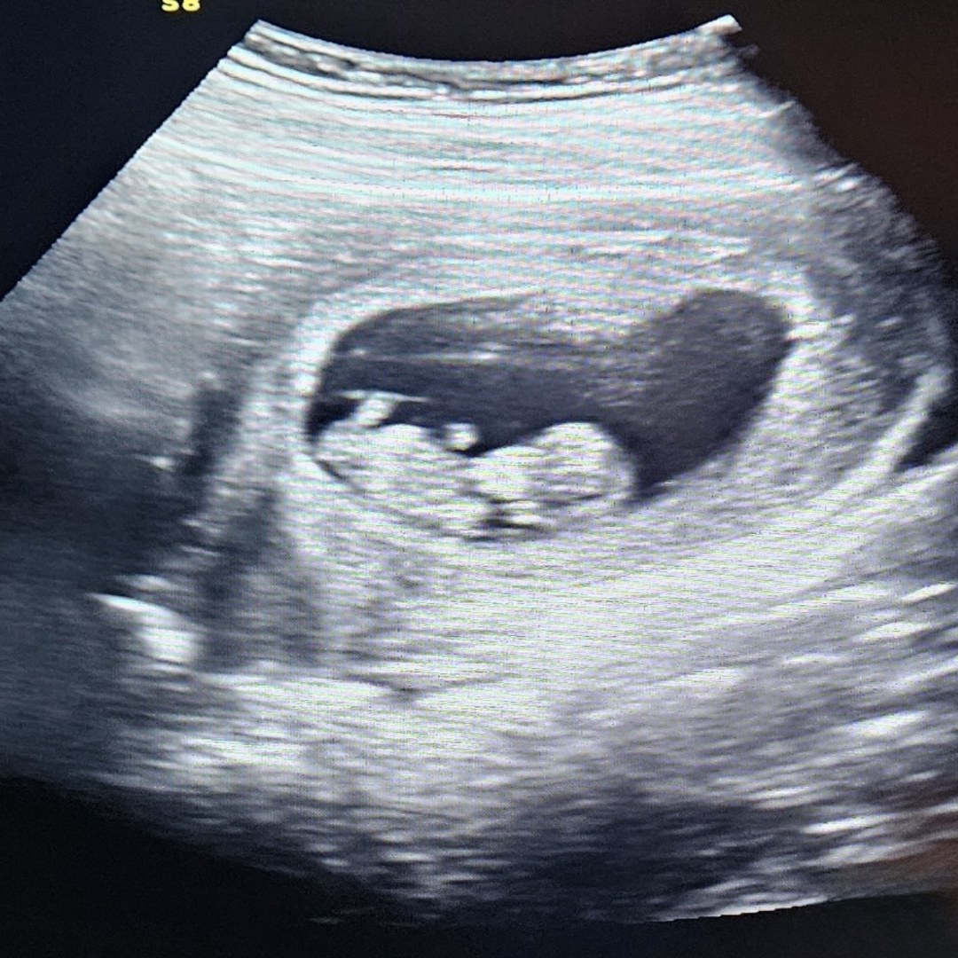 Photo shared by Rebekah for their Babylist baby registry.