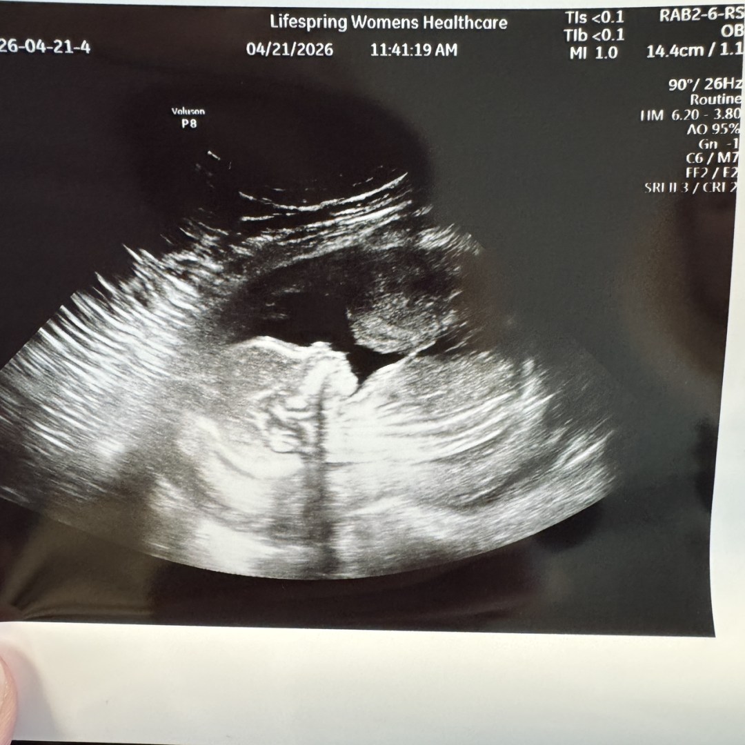 Photo shared by Emily for their Babylist baby registry.
