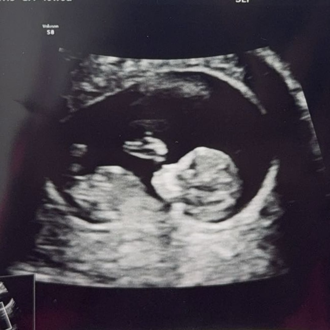 Photo shared by Melanie for their Babylist baby registry.