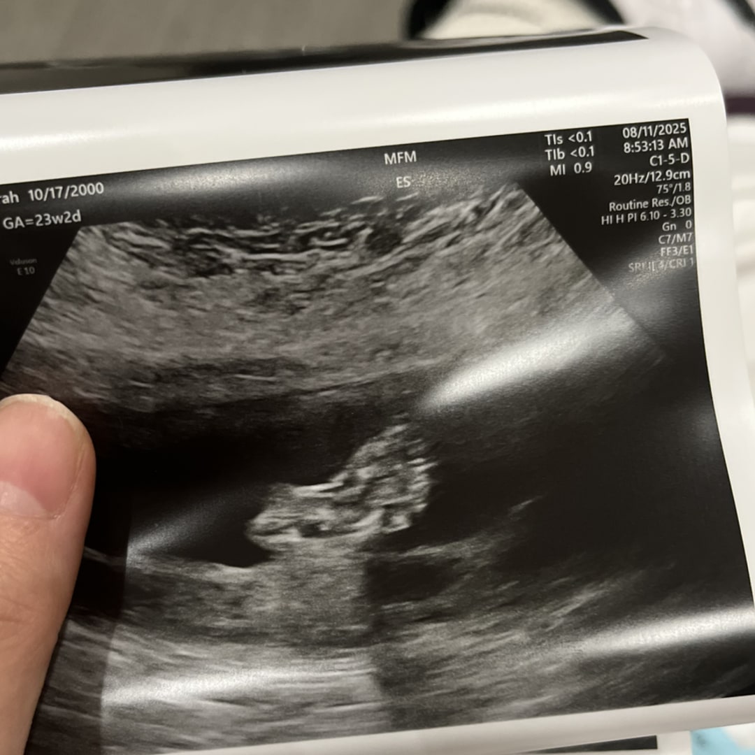 Photo shared by Sarah for their Babylist baby registry.