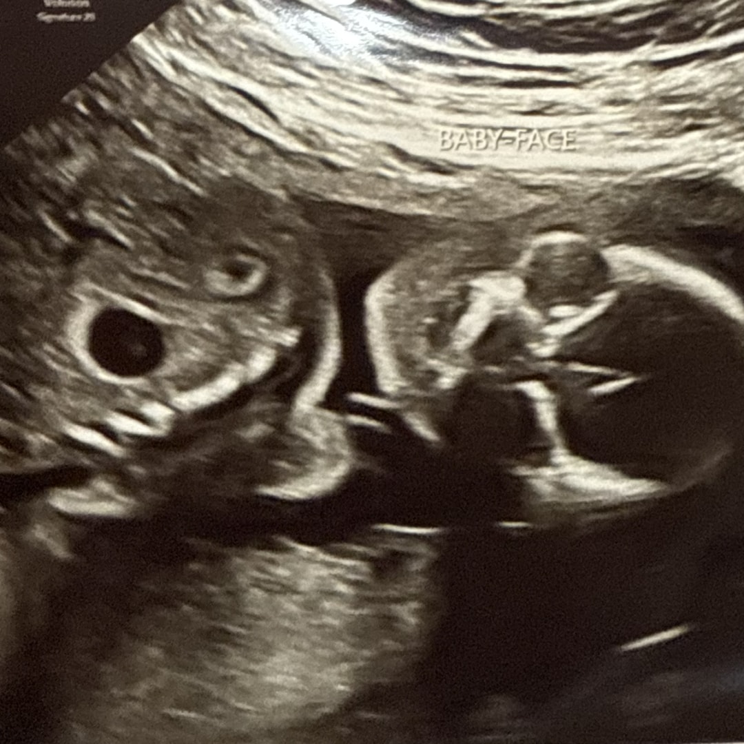 Photo shared by Colleen for their Babylist baby registry.
