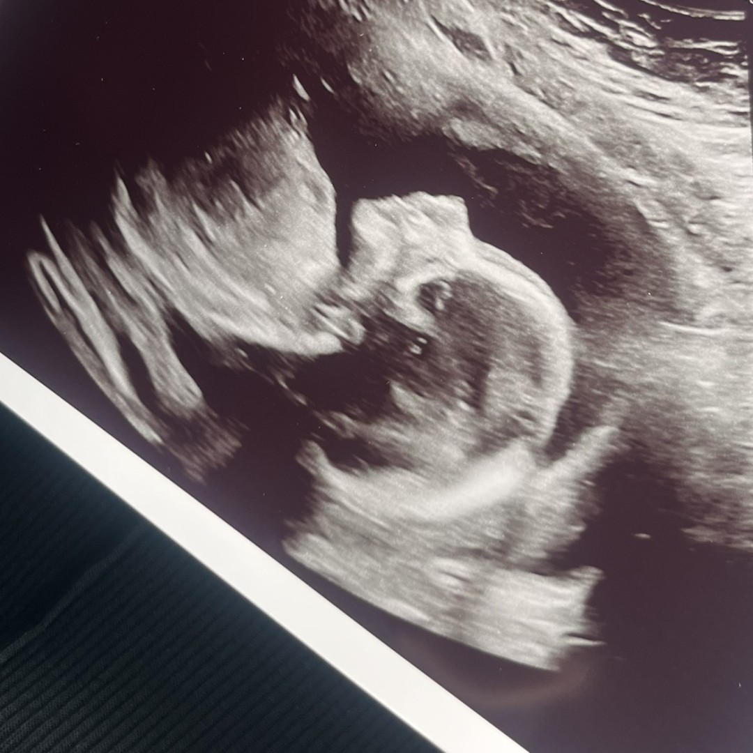 Photo shared by Shelby for their Babylist baby registry.