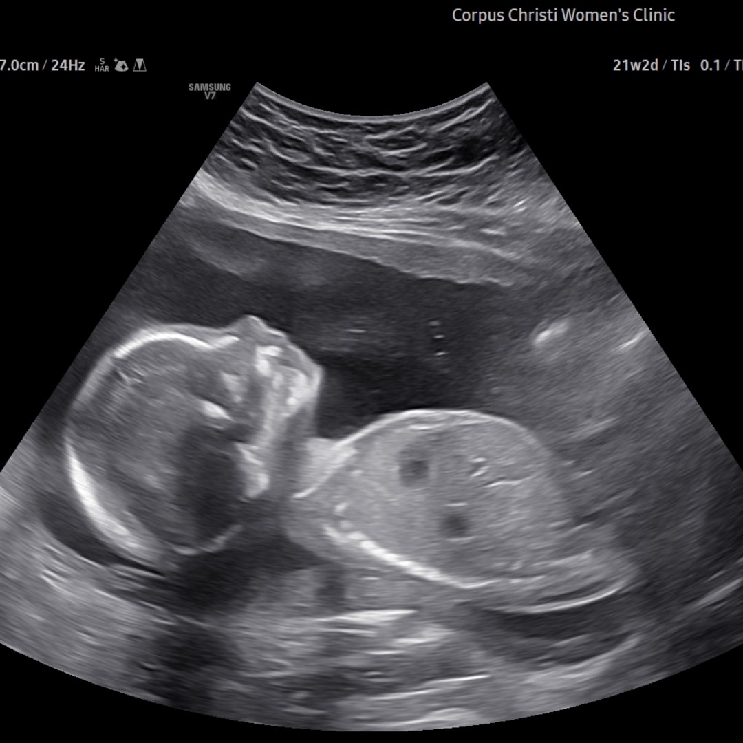 Photo shared by Kyla for their Babylist baby registry.