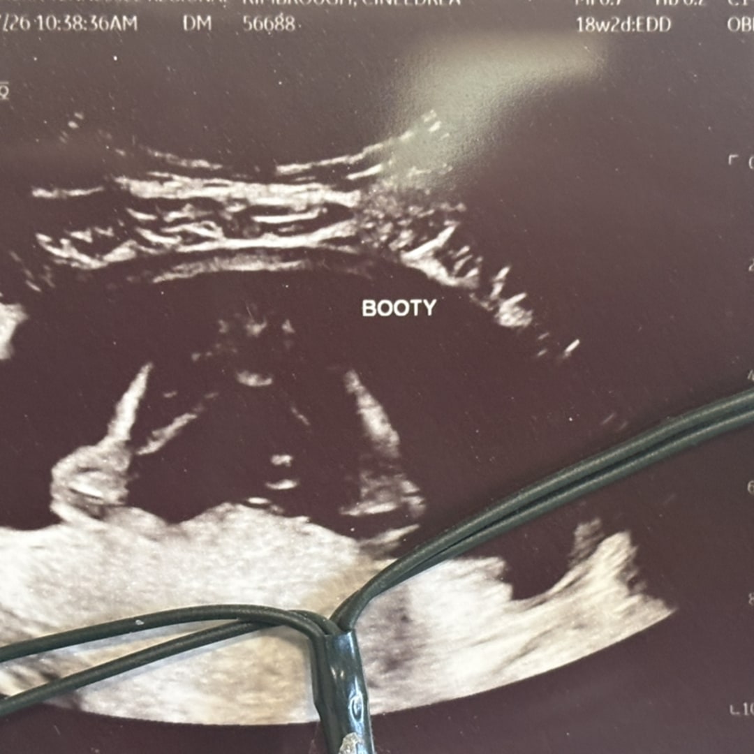 Photo shared by Cineedrea for their Babylist baby registry.