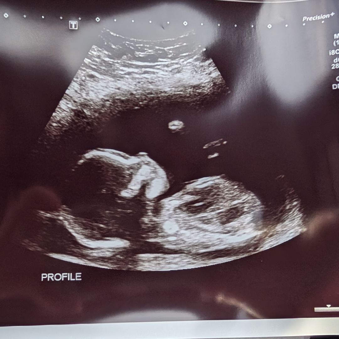 Photo shared by Noelle for their Babylist baby registry.