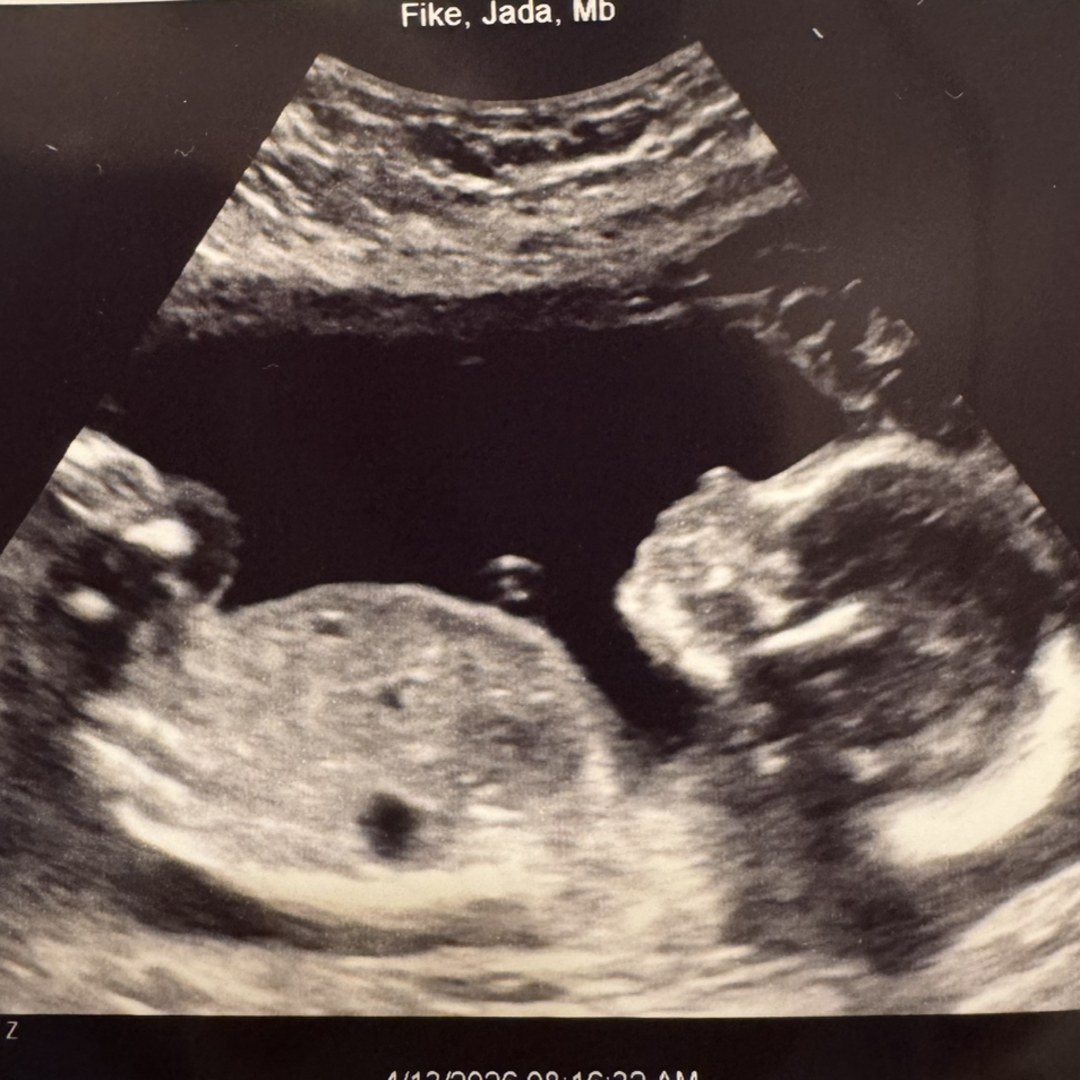 Photo shared by Jada for their Babylist baby registry.