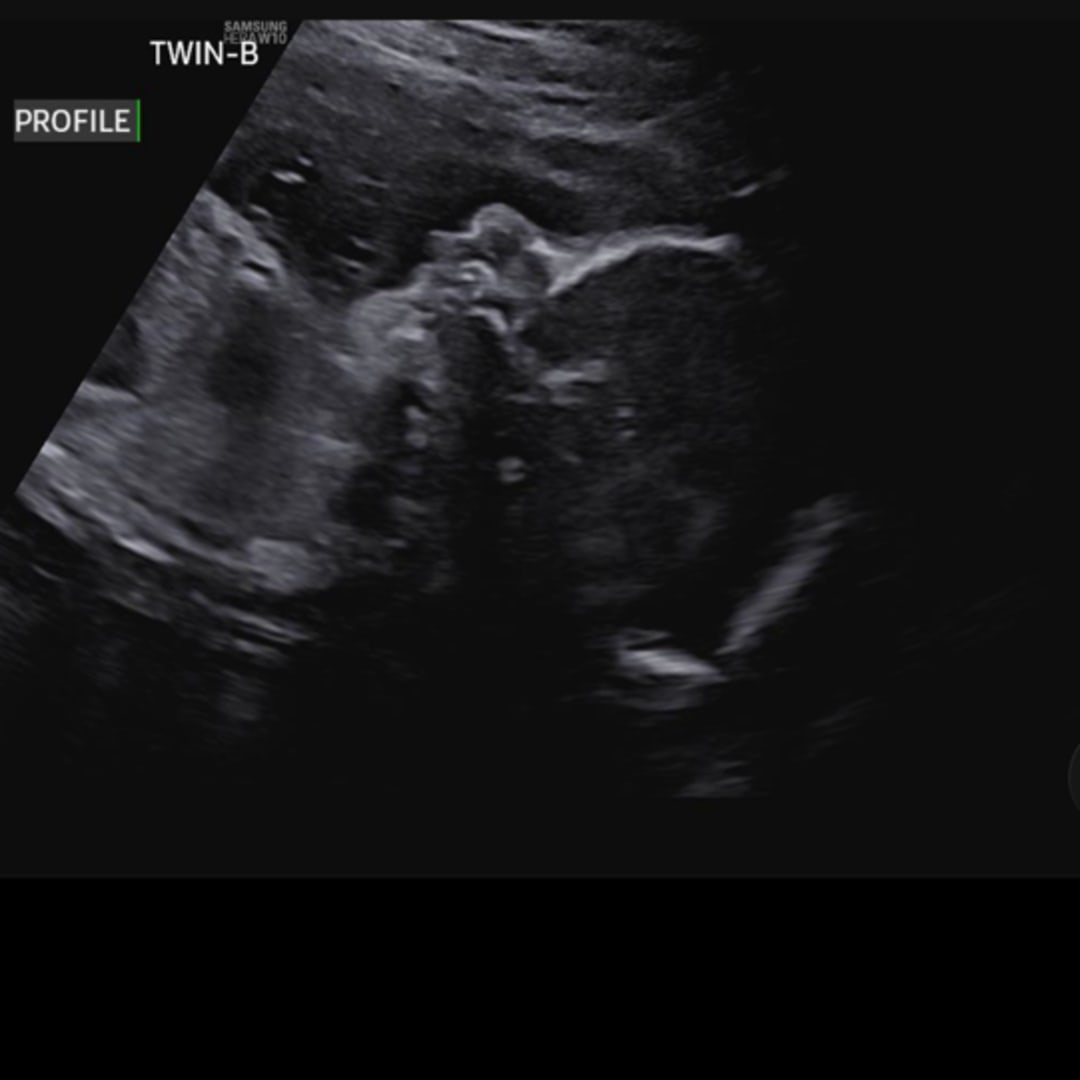 Photo shared by Cesia for their Babylist baby registry.