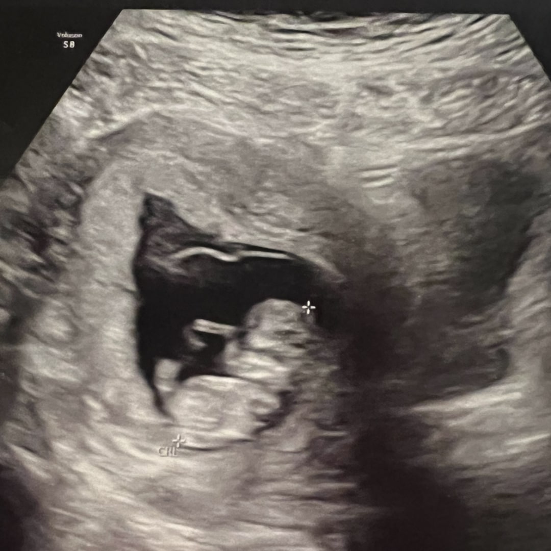 Photo shared by Chasidy for their Babylist baby registry.