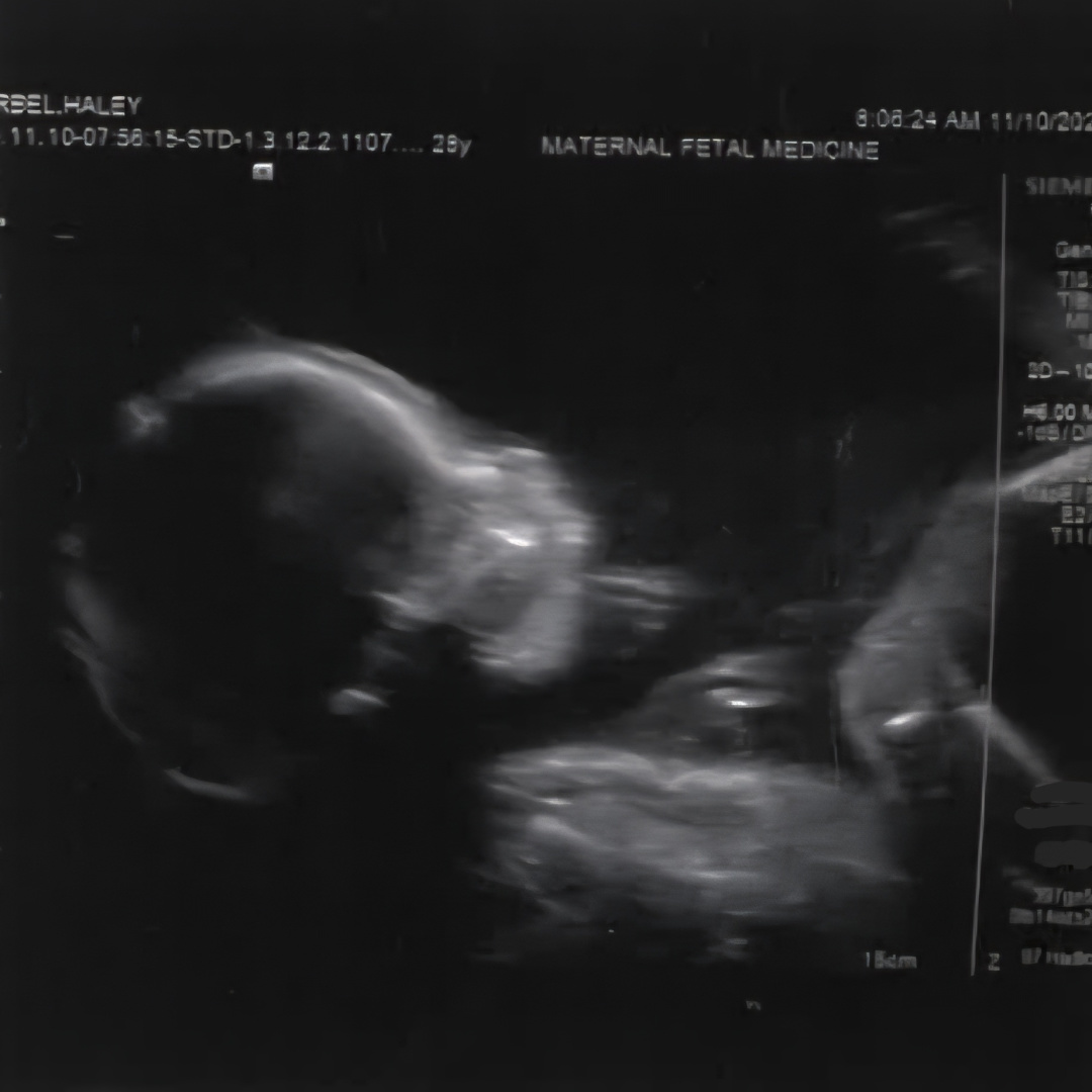 Photo shared by Haley for their Babylist baby registry.