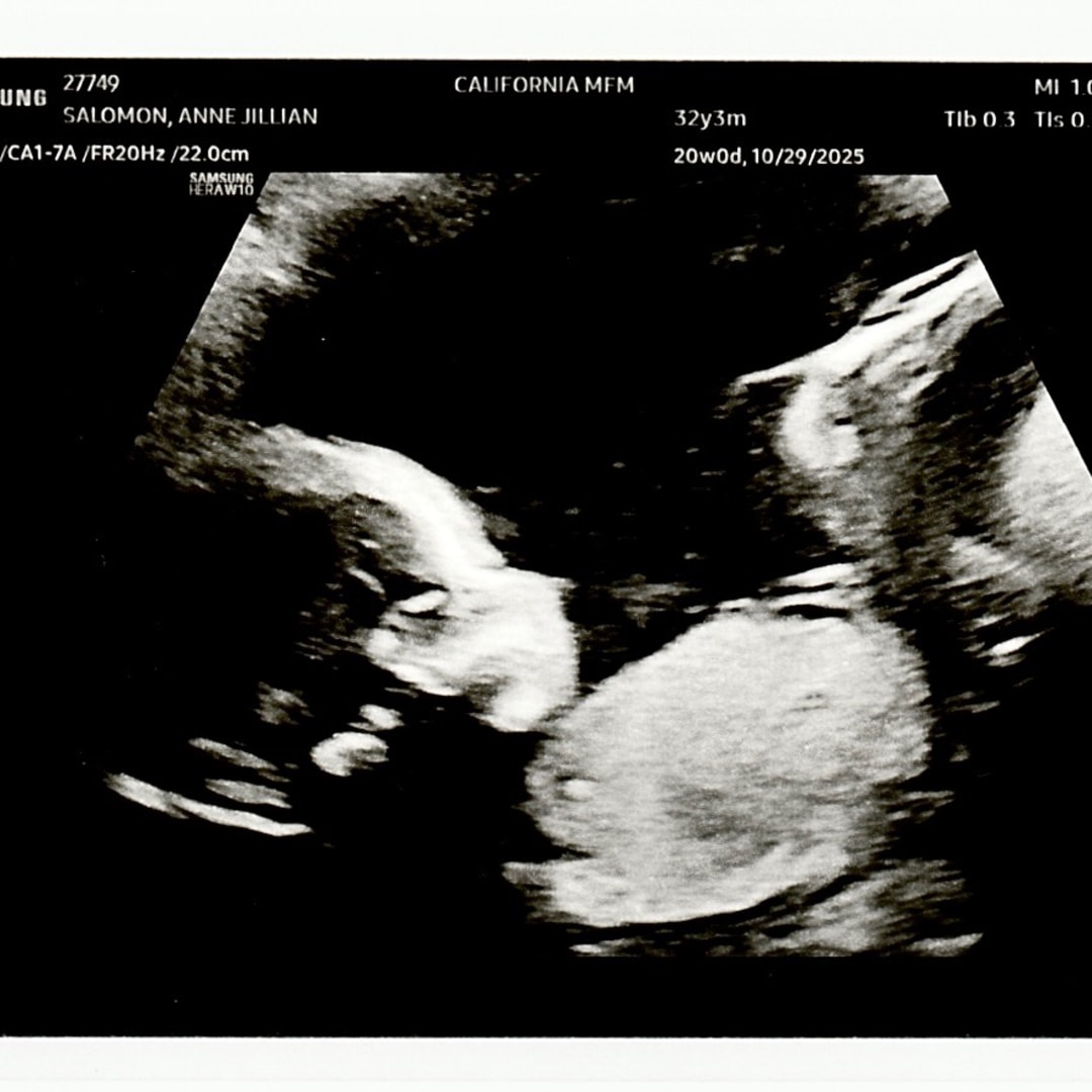 Photo shared by Alvin John for their Babylist baby registry.